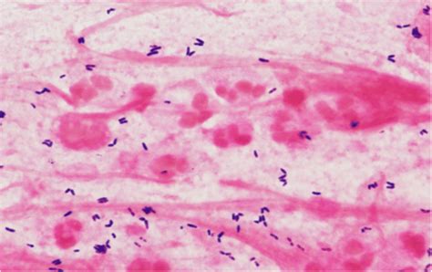 Streptococcus Pneumoniae Culture