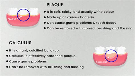 plaque tartar barker dental care