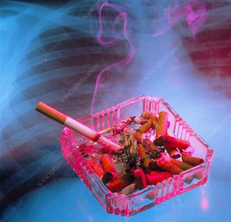 full ashtray with x ray of lungs in background stock image m370 0118 science photo library