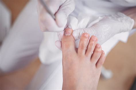 What To Expect When You See A Podiatrist