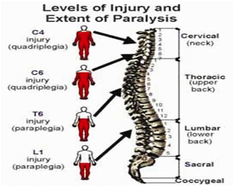Spinal Cord Injury Levels Chart