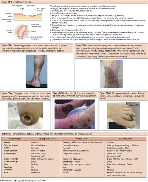 Vascular Ulceration Thoracic Key