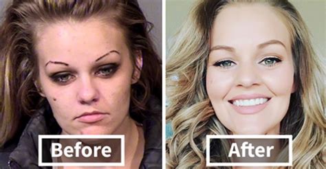 Stunning Before And After Transformations Of People Who Quit Drugs Artfido
