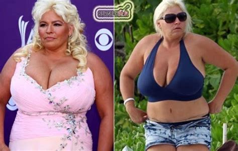 Beth Chapman Plastic Surgery Tummy Tuck Before And After