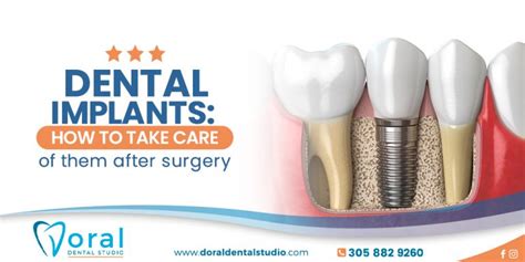 Dental Implants Post Operative Instructions