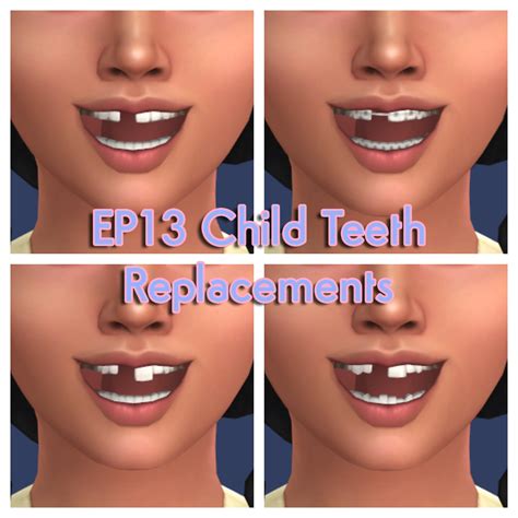 The Original Pearly Whites Teeth Replacements The Sims 4 Create A Sim