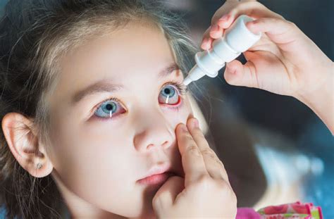 Red Eyes In Children Causes And Treatments