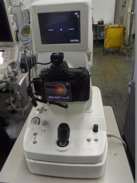 Ophthalmic Equipmentkowanon Mydriatic Fundus Cameranonmyd 7used