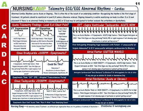 Nursing Cardiac Dysrhythmias Cheat Sheet