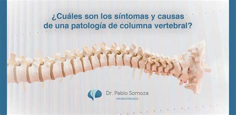 Patolog A De Columna Vertebral S Ntomas Y Causas Dr Pablo Somoza