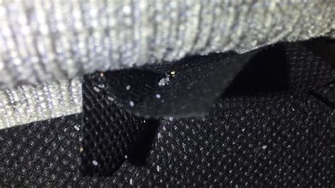 7 Pics What Do Bed Bug Eggs Look Like On Clothes And View Alqu Blog