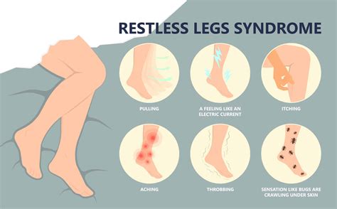 Restless Legs Syndrome Artesia Rls Rancho Cucamonga