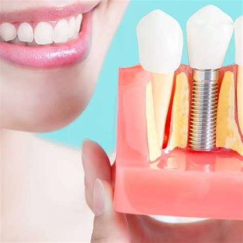 Implant Dentistry Total Smiles Dentistry Richmond Virginia