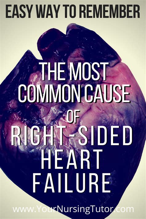 Easily Remember The Most Common Cause Of Right Sided Heart Failure