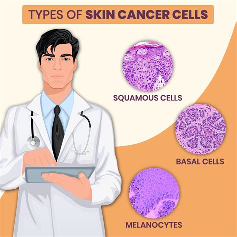 Understanding The Different Types Of Skin Cancer Treatment Zeeva Clinic