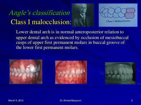 Etiology Of Malocclusion I
