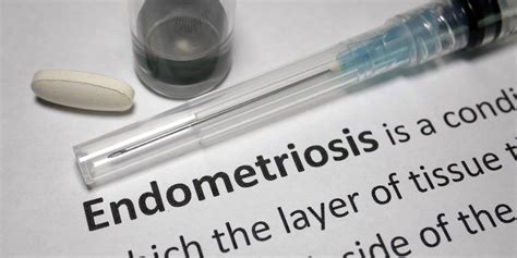 fast facts what you need to know about endometriosis healthywomen