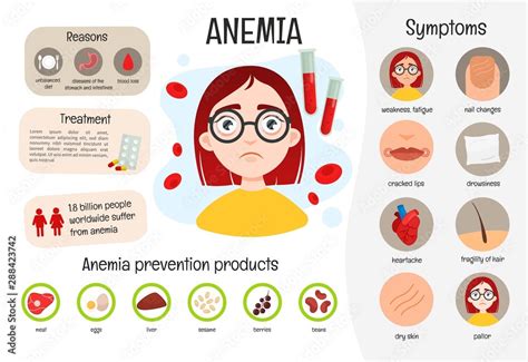 Vector Medical Poster Anemia Symptoms Of The Disease Prevention