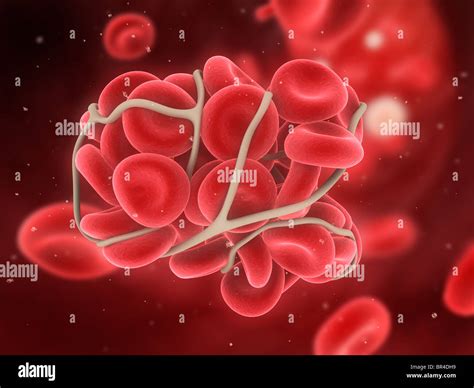 Blood Clot Hi Res Stock Photography And Images Alamy