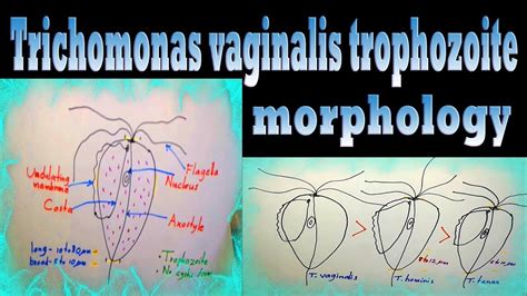 Trichomonas Vaginalis Morphology How To Differentiate From Other
