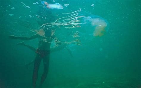 Teenager Killed By Box Jellyfish Sting In Australia