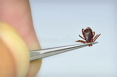Dog Tick Removal Stock Photo Image Of Bacteria Ixodes 21818248