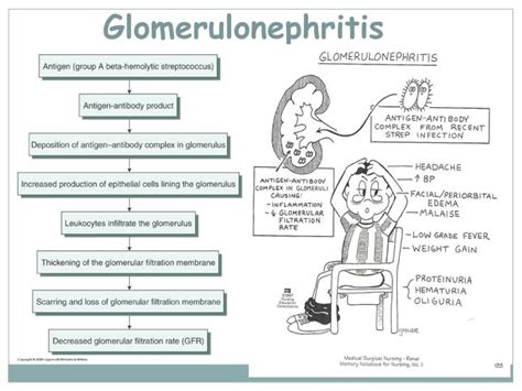 Ppt Introduction To Nephrology Acute And Chronic Glomerulonephritis