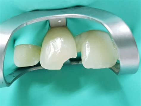 Operatoria Dental Clínica Dental Schamann