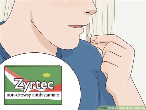 3 Ways To Treat Hives Naturally Wikihow