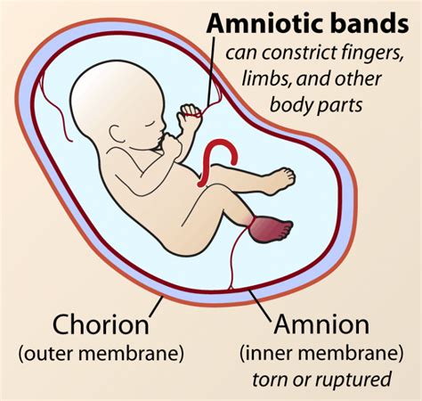 Fetal Membrane Layers Chorion Amnion Yolk Sac And Umbilical Cord