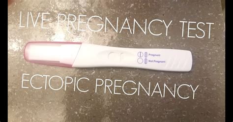 Will A Pregnancy Test Be Negative With An Ectopic Pregnancy