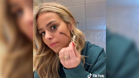 Scar Girl Tiktok Trending Images Gallery List View Know Your Meme