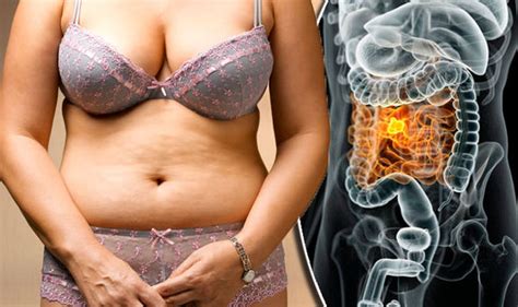 Belly Fat Abdominal Obesity Can Increase Risk Of Deadly Cancer