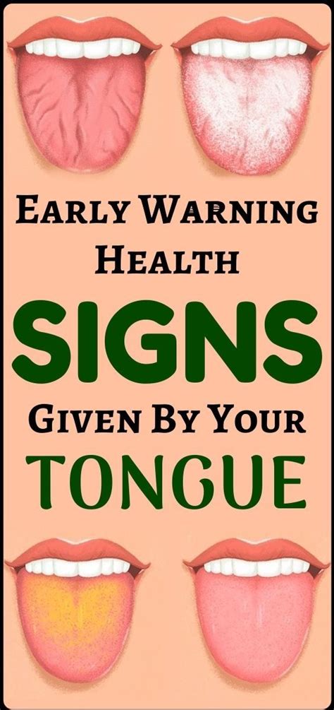 Its What Your Tongue Says About Your Health The Top Inspired In 2020