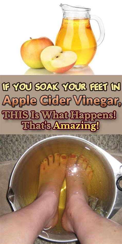 If You Soak Your Feet In Apple Cider Vinegar This Is What Happens