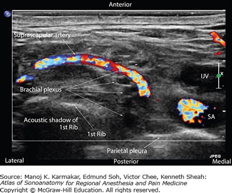 Sonoanatomy Relevant For Ultrasound Guided Upper Extremity Nerve Blocks