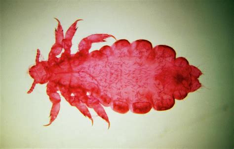 Lm Of A Female Human Body Louse Photograph By Eric Grave Science Photo