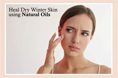 Heal Dry Winter Skin Using Natural Oils