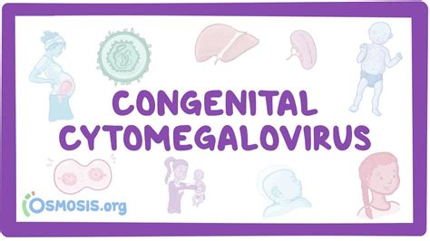 Congenital Cmv Causes Symptoms Diagnosis Treatment Pathology