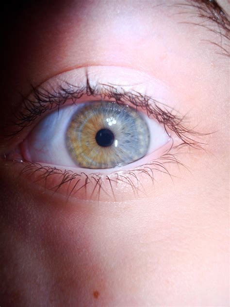 Sectoral Heterochromia By Iamthequam On Deviantart