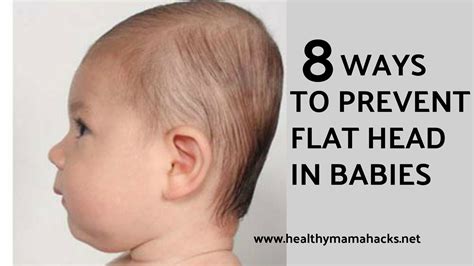 Plagiocephaly How To Prevent Flat Head In Babies Healthy Mama Hacks