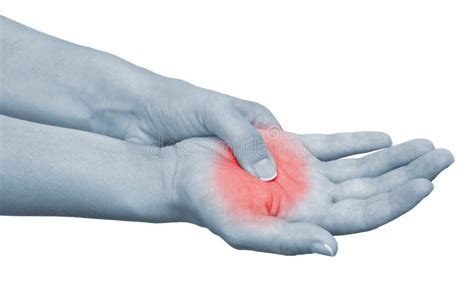 Acute Pain In A Woman Wrist Stock Photo Image Of Therapy Cramp 22948542