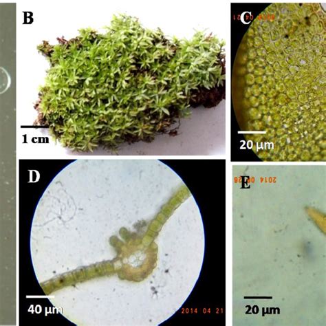 General Morphology Of Pogonatum A Male Gametophytes With Perigonia On