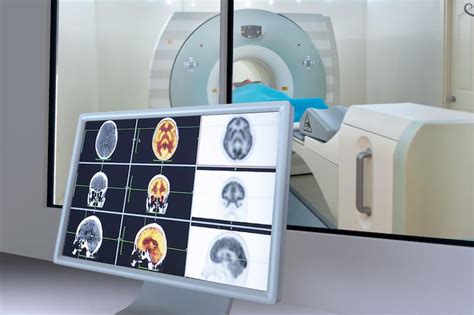 What Is Magnetic Resonance Imaging Mri Independent Imaging