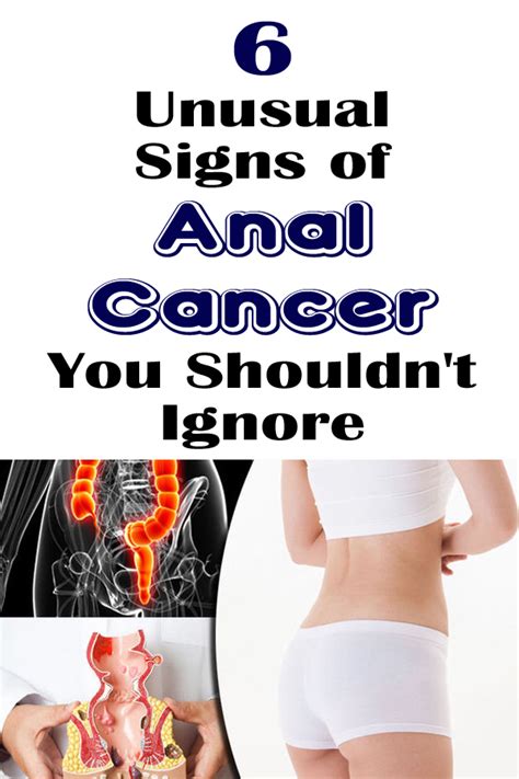 6 Unusual Signs Of Anal Cancer You Shouldn T Ignore