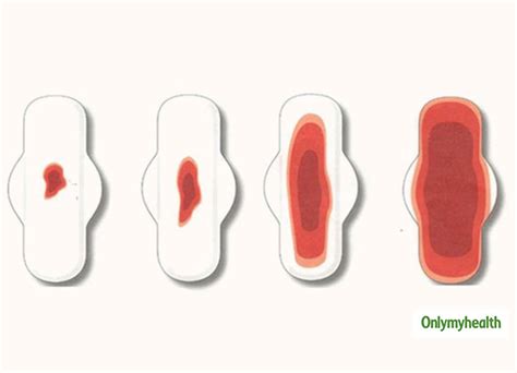 What Is Ovulation Bleeding Know About This Condition From