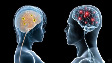 Man Brain Versus Womens Brain Brainlyqh