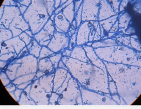 Lacto Phenol Cotton Blue Lpcb Mount Showing Septate Hyphae And