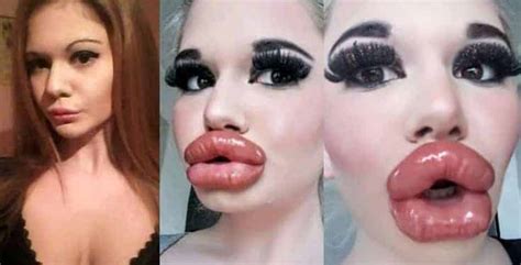 Meet Andrea Ivanova The Lady Who Has Spent Over 10000 On Her Lips Ghpage