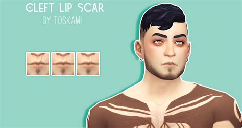 Wcif Cleft Lip Scar Fulfilled Sims 4 Studio